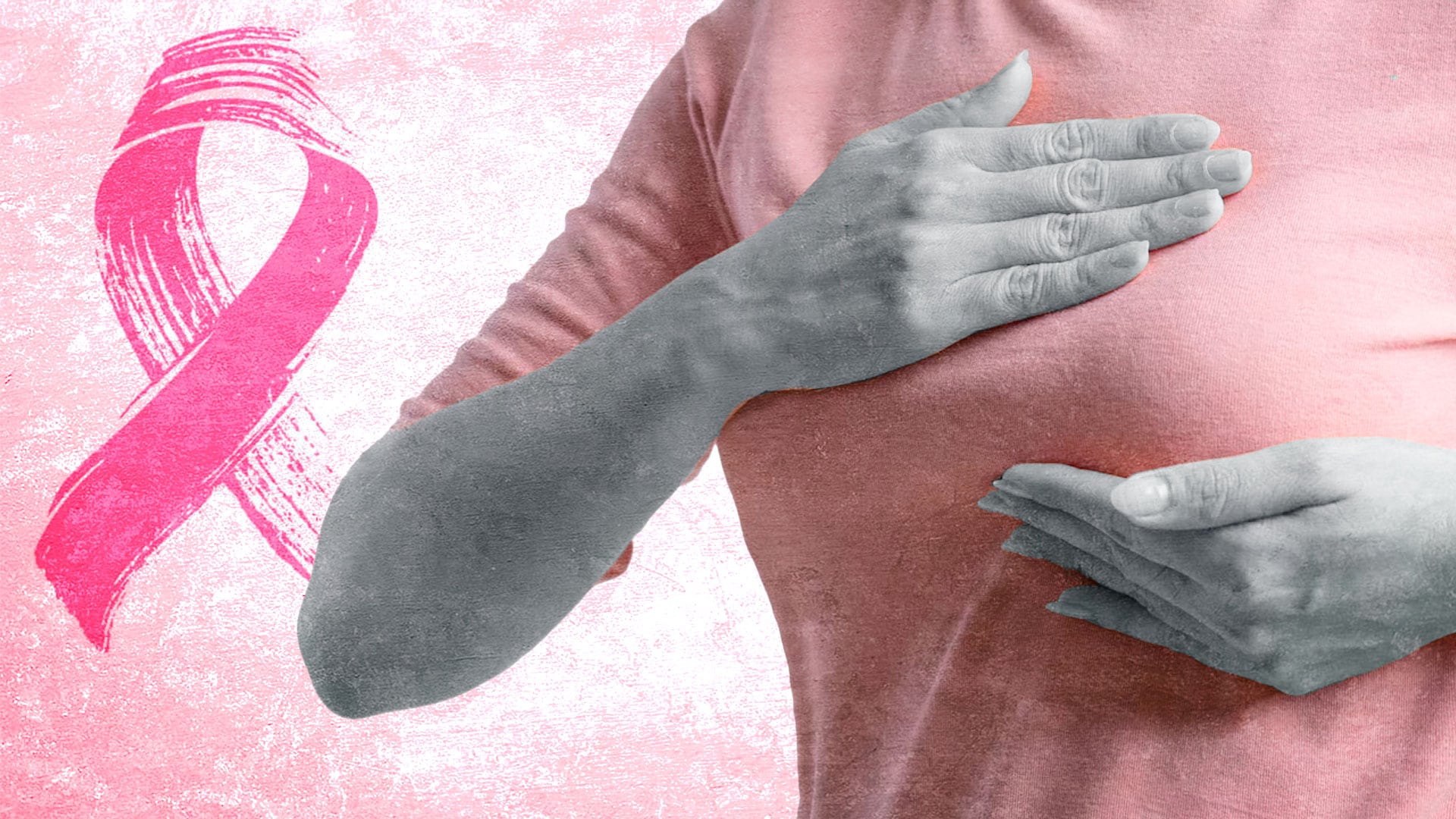 El peso invisible del sobreviviente: el miedo a la recaída afecta al 70% de las pacientes de cáncer