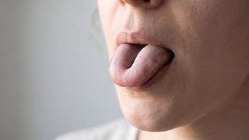 Esto revela la ciencia sobre ti si puedes enrollar tu lengua como “taco”