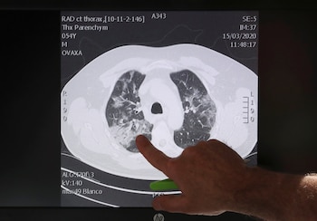 Uno de los estudios, de