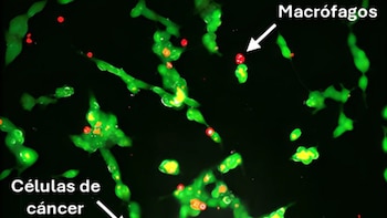 Desarrollan una estrategia para tratar