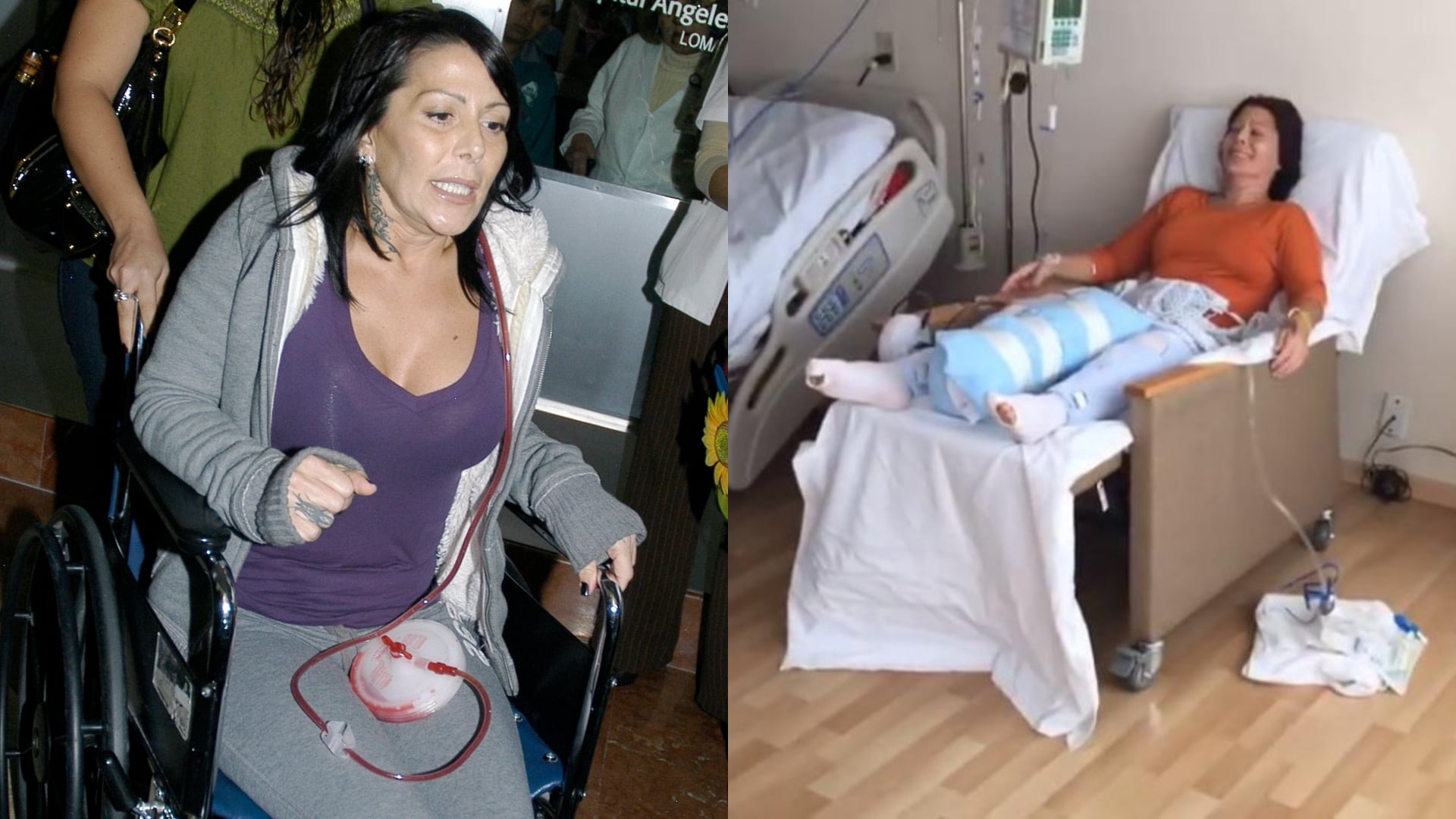 Polímeros y prótesis de titanio: los duros problemas de salud de Alejandra Guzmán que provocan que se “zafe” su cadera(rs)