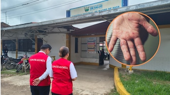 Diresa Madre de Dios sin presupuesto para afrontar brote de sarampión, advierte Contraloría