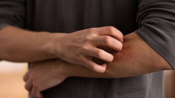 El uso frecuente de detergente