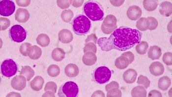 Los tratamientos cada vez van