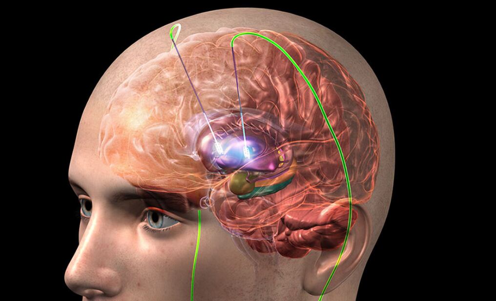 La intervención, considerada de alta complejidad, marcó un antes y un después en la aplicación de esta técnica en la región. Fuente: Pincel Digital