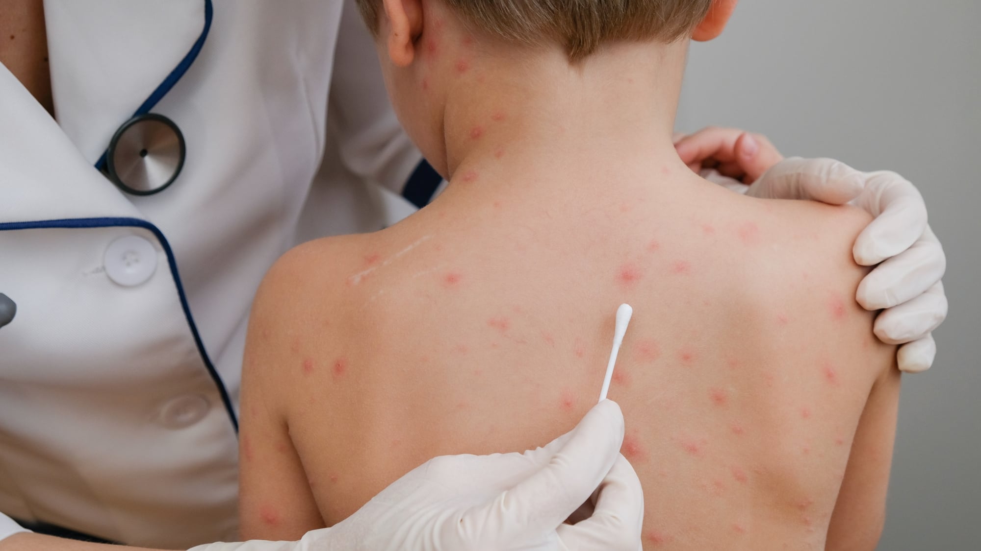 Jarbas Barbosa, director de la OPS, explicó en conferncia mundial: