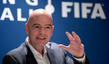 Gianni Infantino presenta "síntomas leves"