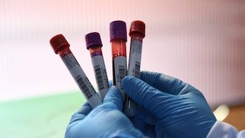 1.100 personas necesitan una transfusión de sangre cada día para continuar con sus tratamientos médicos o enfrentar emergencias, alertó el INS