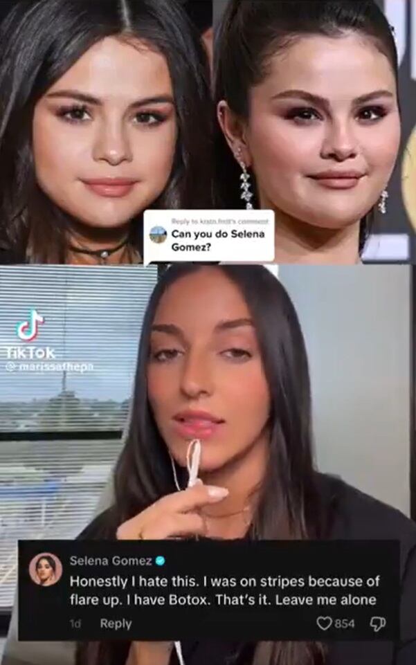 Selena Gomez negó haber pasado por una cirugía estética (TikTok/@marissathepa)