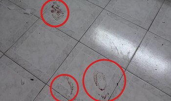 Las manchas de sangre de