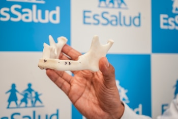 El equipo médico de EsSalud