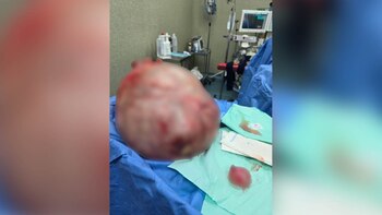 La paciente fue dada de