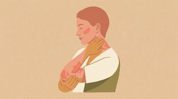 Ilustración de perfil de una persona con manchas enrojecidas en la piel del codo y el cuello sobre fondo beige.