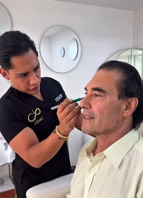 Eduardo Yáñez sorprende en redes sociales con su rejuvenecimiento facial no invasivo (IG)