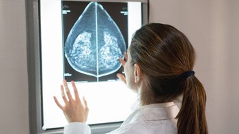 Unrecognizable female gynocologist looking at a patients mammogram at the hospital