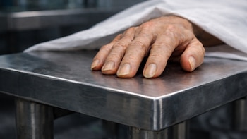 ¿El pelo y las uñas