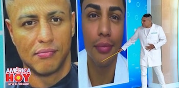 Cirujano cuenta qué arreglos se