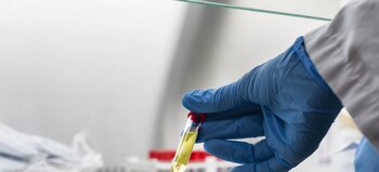10/11/2020 Coronavirus.- La OPS dona 190.000 pruebas diagnósticas de la COVID-19 a Ecuador, El Salvador, Honduras y Surinam.
La Organización Panamericana de la Salud (OPS) ha donado 190.000 pruebas diagnósticas de la COVID-19 a Ecuador, El Salvador, Honduras y Surinam, que se destinarán a lugares remotos.
POLITICA ESPAÑA EUROPA MADRID INTERNACIONAL
WHO AFRICA