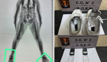 Radiografía corporal con marcas verdes en los pies junto a unas zapatillas ahuecadas y dos teléfonos móviles sobre una mesa