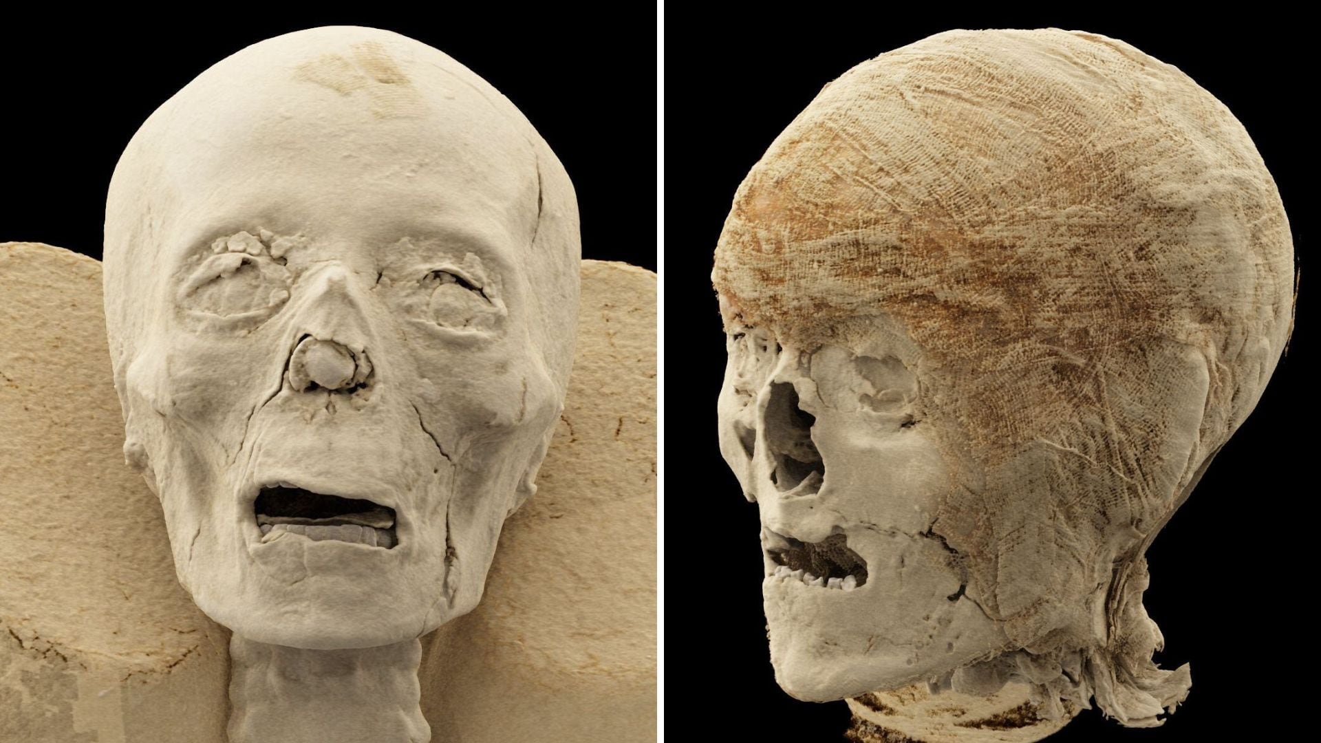 Una momia conservada por más de dos mil años en un museo de Hungría ha revelado información previamente desconocida gracias a la tecnología médica (Museo Nacional de Historia de la Medicina Semmelweis, MNMKK)