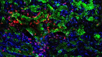 El CNIO identifica cómo las