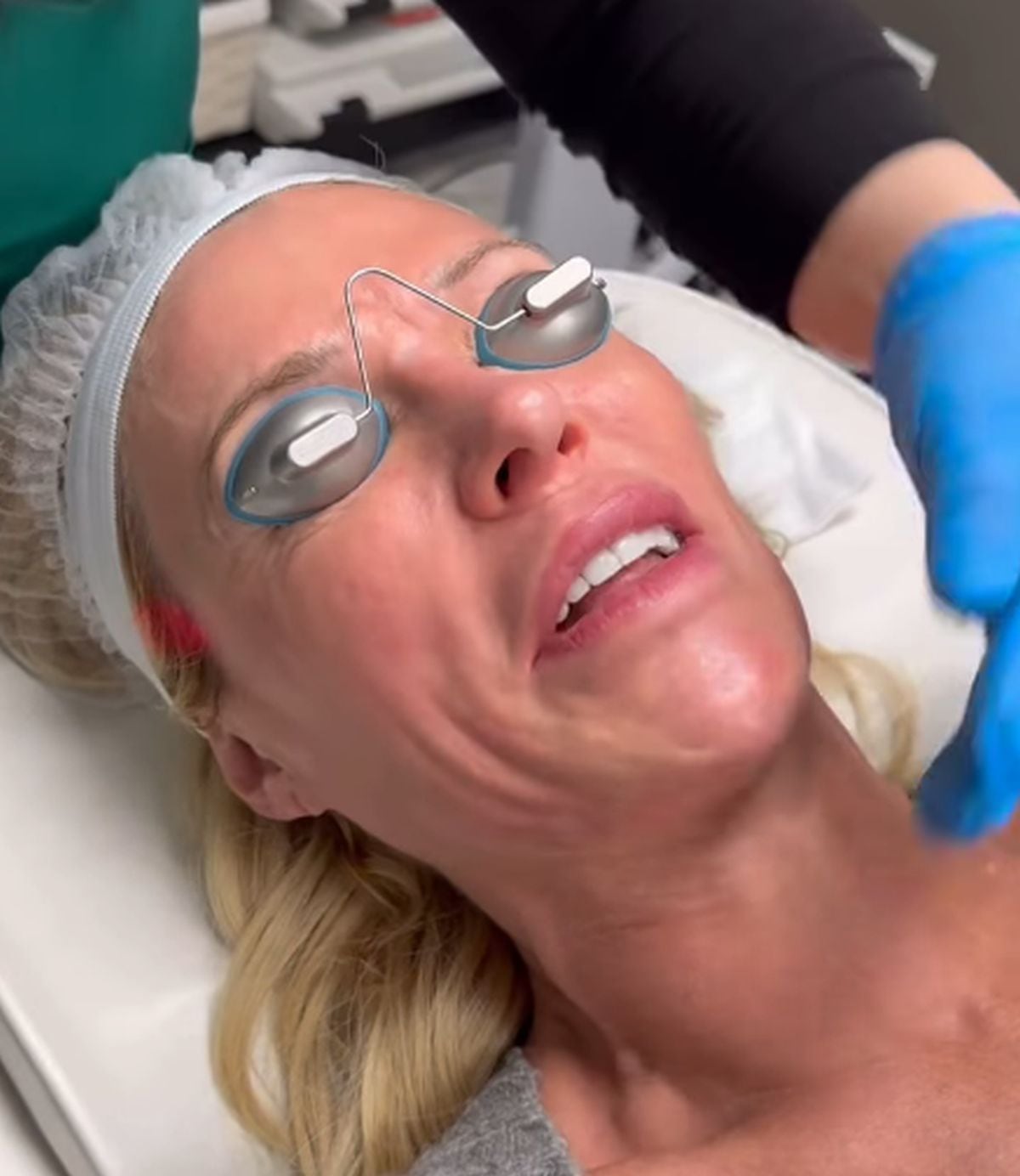 Brandi Glanville afirmó que el tratamiento no ha sido fácil, que vio muy poca mejora y que todavía le quedan cirugías y meses de tratamiento (Instagram/@brandiglanville)