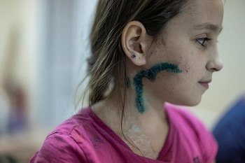 Foto de Milana, una niña de 11 años que se recupera de las heridas en un hospital en Zaporizhzhia (REUTERS/Marko Djurica)