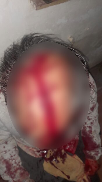 La víctima recibió tres machetazos