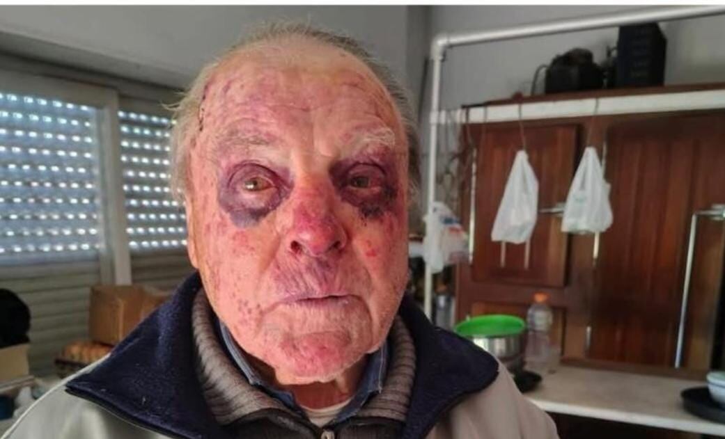 Así quedó el jubilado golpeado