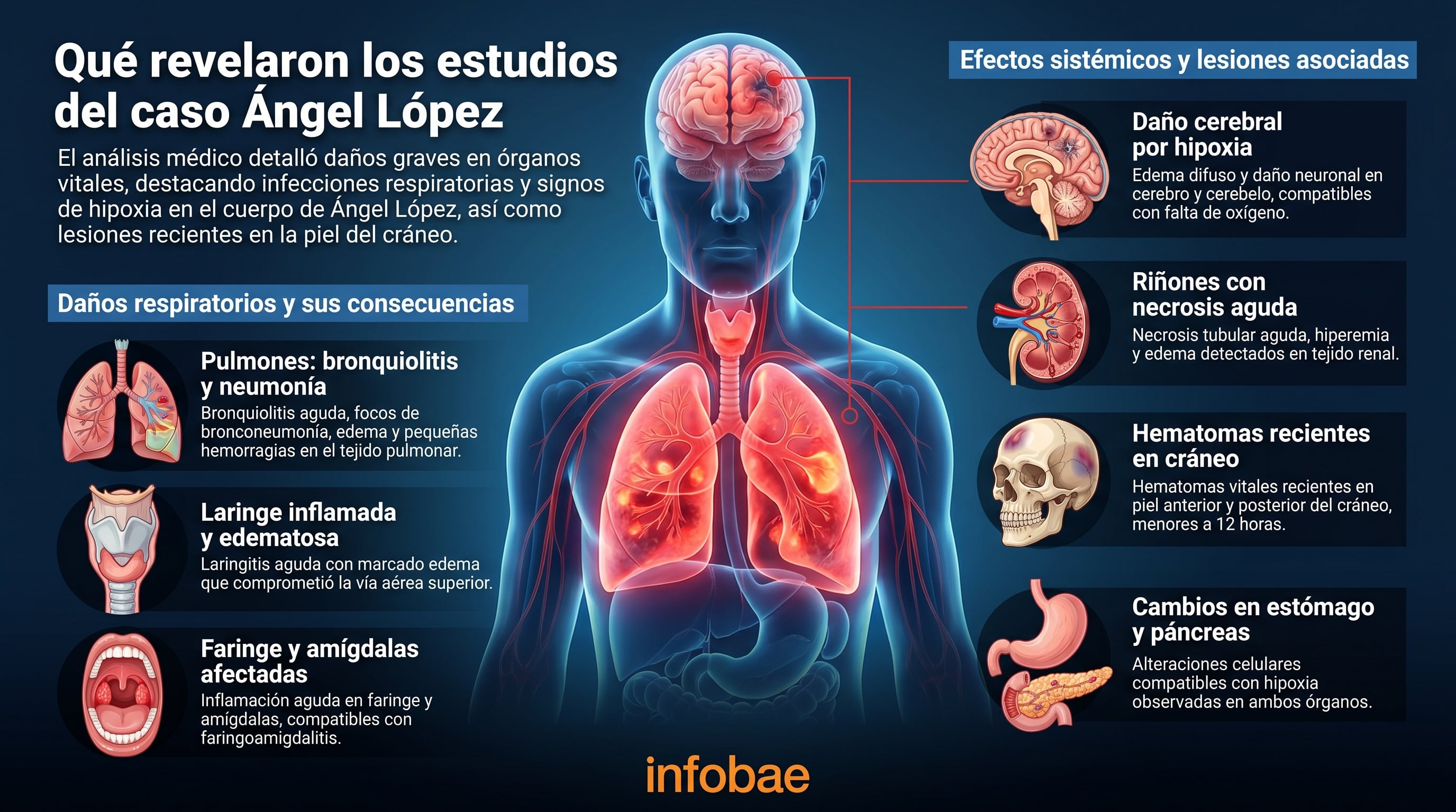 El análisis médico del caso Ángel López detalló graves daños en órganos vitales, destacando infecciones respiratorias, signos de hipoxia y hematomas recientes en el cráneo. (Imagen Ilustrativa Infobae)