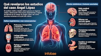 Ilustración médica de un cuerpo humano transparente con órganos internos resaltados, detallando lesiones en pulmones, laringe, cerebro, riñones, cráneo y estómago.