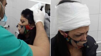 La mujer sufrió un corte