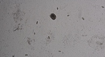 Vista microscópica en blanco y negro con varias formas celulares y pequeños fragmentos dispersos sobre un fondo claro