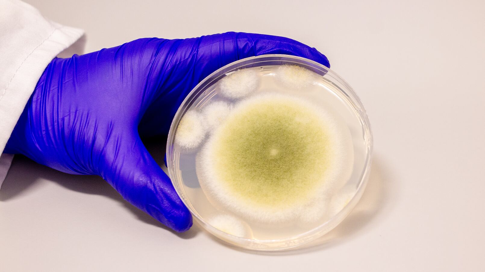 El estudio reveló que la adición de lípidos y el gen SLC46A3 potencian la acción de las asperigimicinas en células malignas (Universidad de Pensilvania/Bella Ciervo)