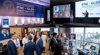 Escenas de un congreso de neurocirugía en Buenos Aires: un orador presenta ante pantalla grande, asistentes conversan y equipos robóticos quirúrgicos se exhiben con vistas de la ciudad.