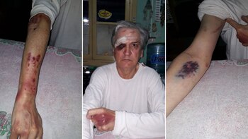 El jubilado mostrando algunas de