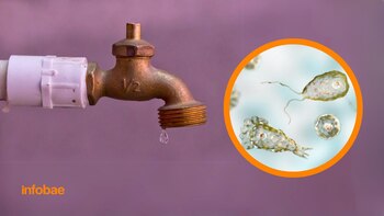 Las infecciones por ameba 'come