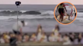 Niño resulta con quemaduras en