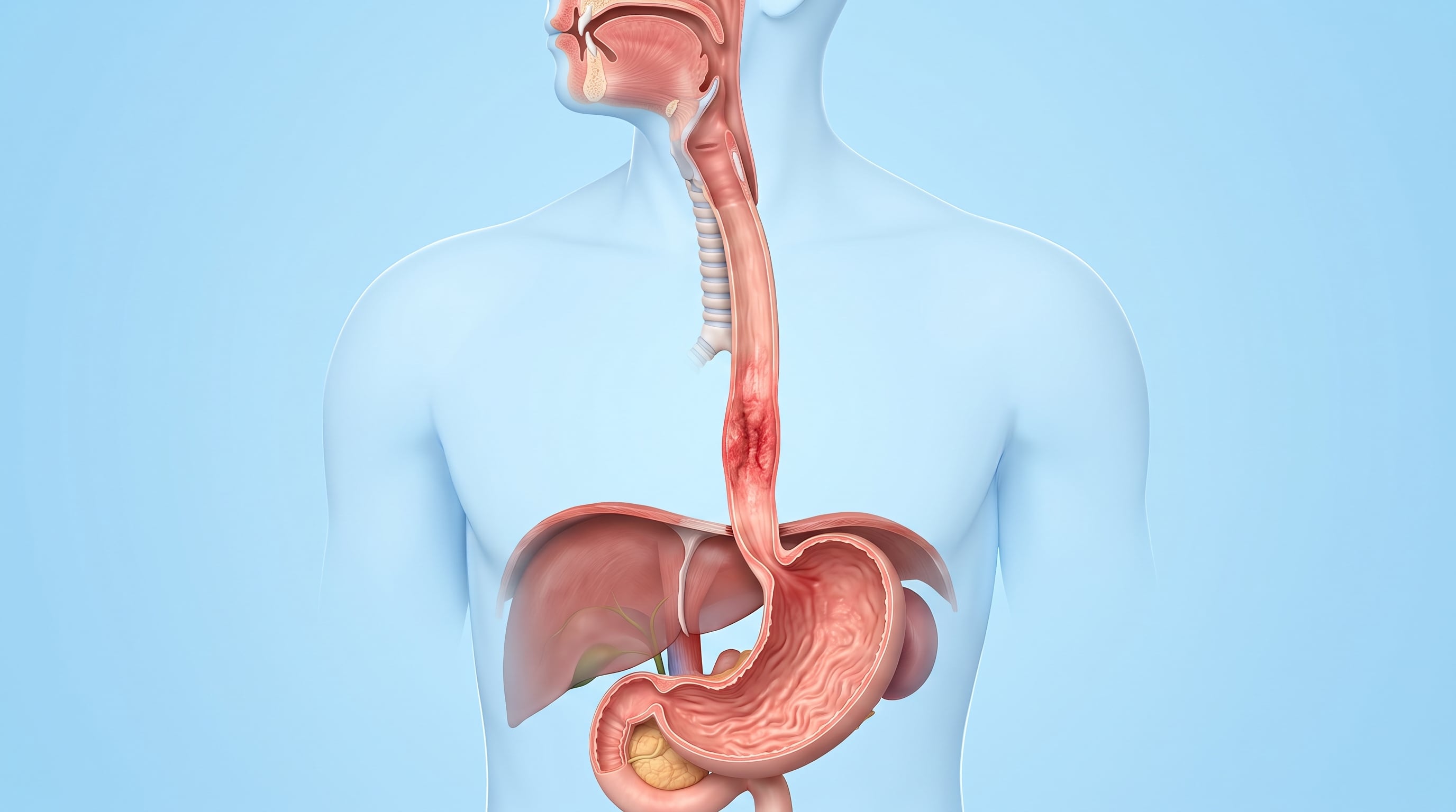 La esofagitis consiste en la irritación o inflamación del revestimiento interno del esófago y no equivale a un diagnóstico de cáncer (Imagen Ilustrativa Infobae)