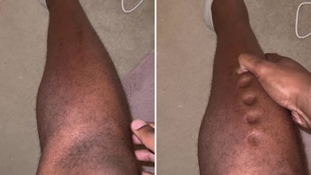 El fenómeno que mostró un