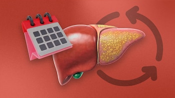 ¿Cuánto tiempo tarda en curarse