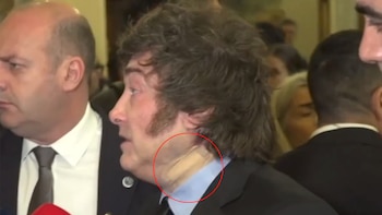 El Gobierno informó la razón por la que Javier Milei usó una venda durante su viaje a España