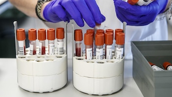 Un brote de sarampión deja