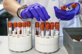 Personal técnico de laboratorio prepara