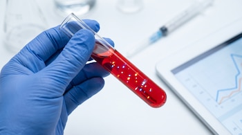 Mano con guante azul sostiene un tubo de ensayo con sangre roja y partículas luminosas; una tableta con un gráfico y material de laboratorio al fondo.