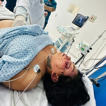 Paola Suárez señaló que podría