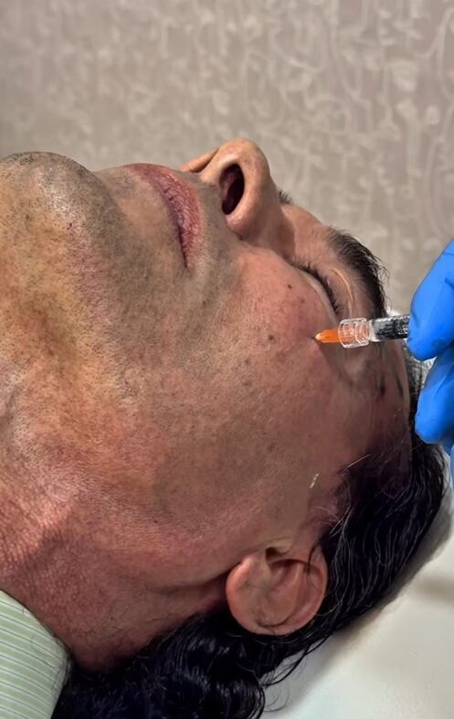El actor de 64 años muestra su transformación tras un tratamiento estético avanzado (IG)