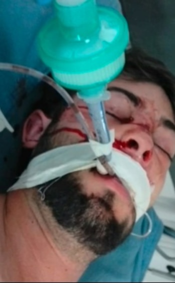 Las heridas del joven fueron producidas tras la golpiza del taxista - crédito Ttai Laguado / Facebook