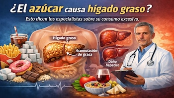 ¿El azúcar causa hígado graso?