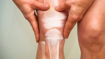 Estos son los alimentos comunes